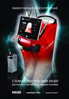 Лазеры